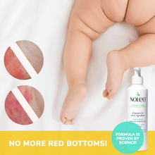 Load image into Gallery viewer, NOLEO DUO: 3-in-1 Diaper Rash Cream &amp; Large Cotton Pads
